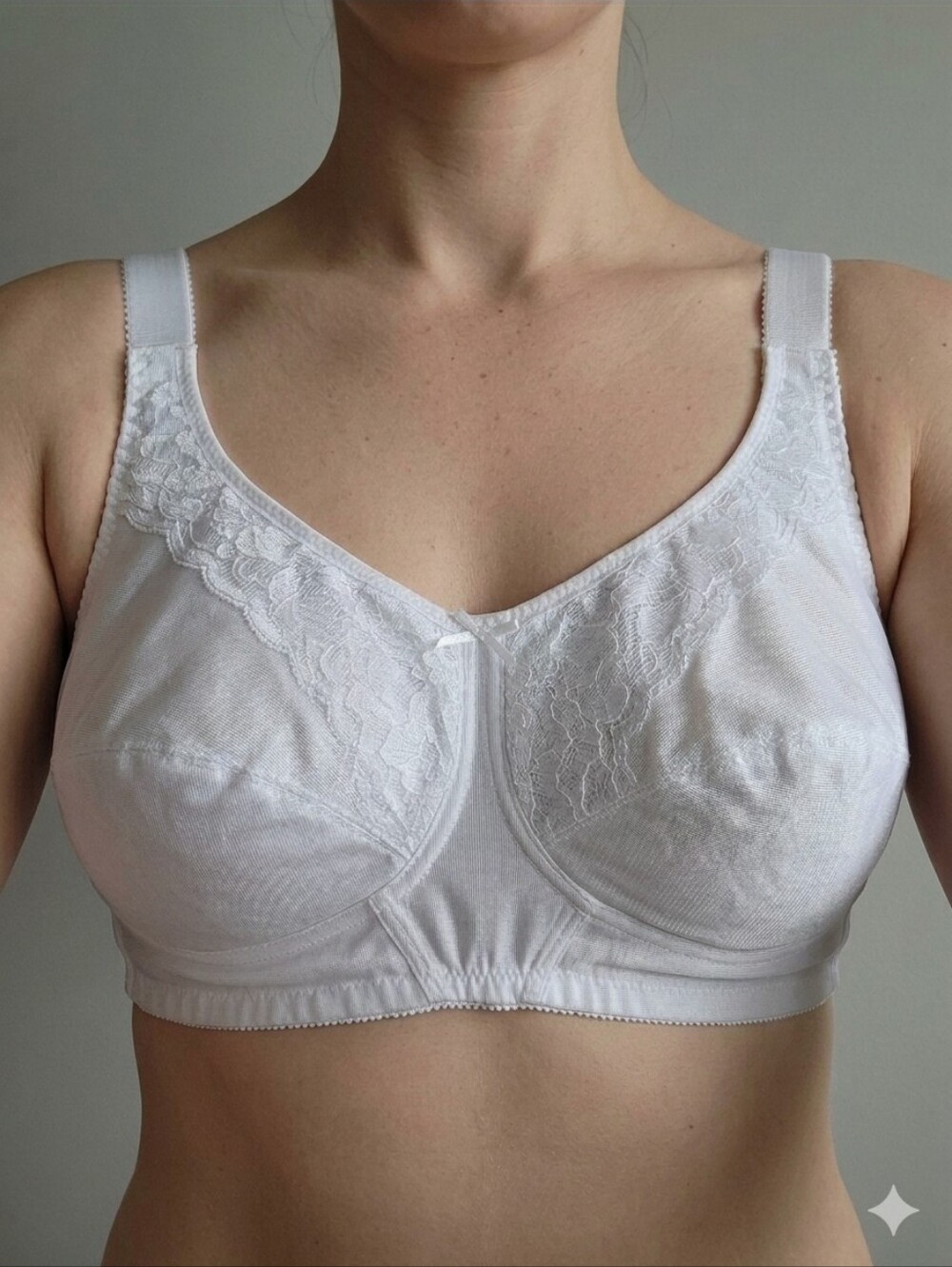 Trulife Classic Full Support Softcup "Irene" Mastectomy Bra - 38D - White